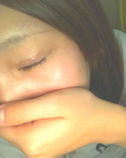 アイテープ 埋没式両面テープ/DAISO/二重まぶた用アイテムを使ったクチコミ(3枚目)