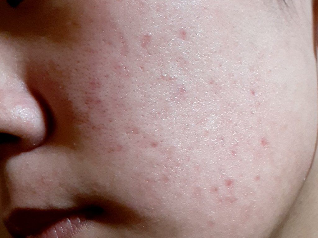 乳液・敏感肌用・さっぱりタイプ/無印良品/乳液を使ったクチコミ（2枚目）