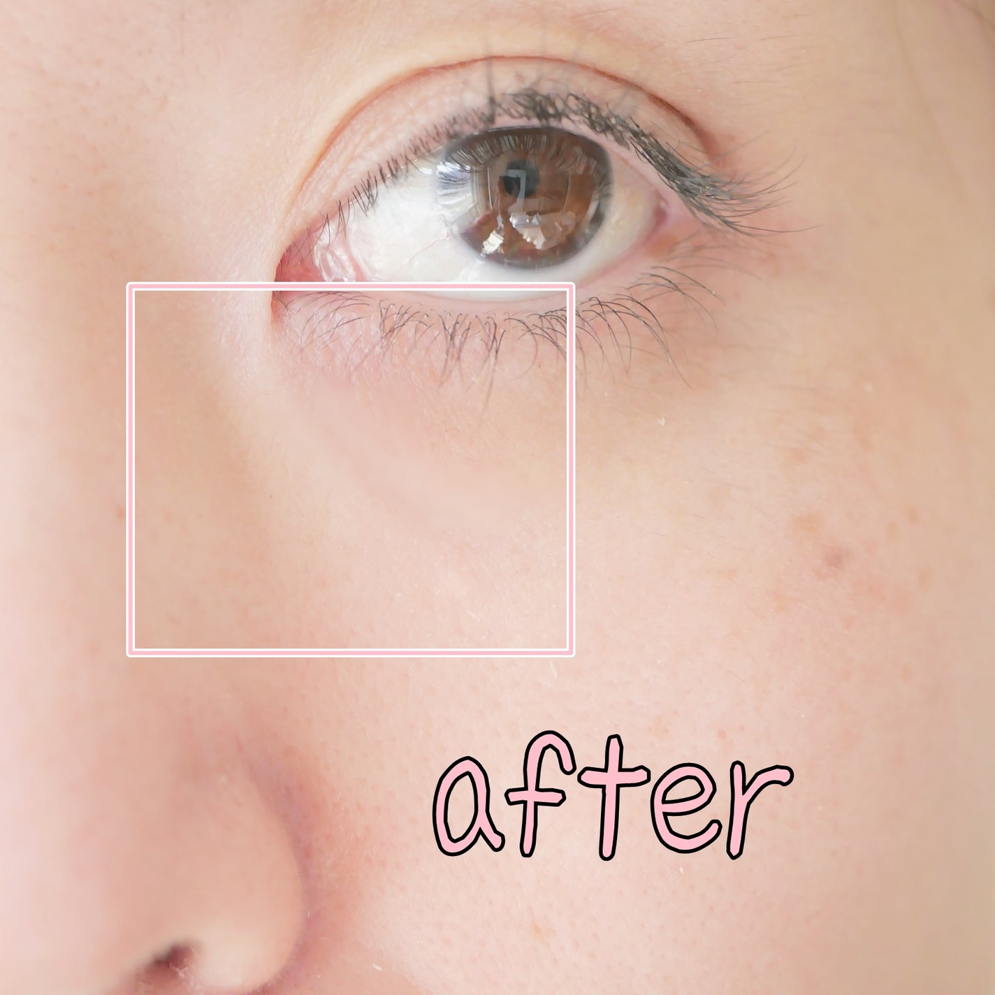 vitoas(ビトアス) マイパーフェクション I しっとり/vitoas/美容液を使ったクチコミ(7枚目)