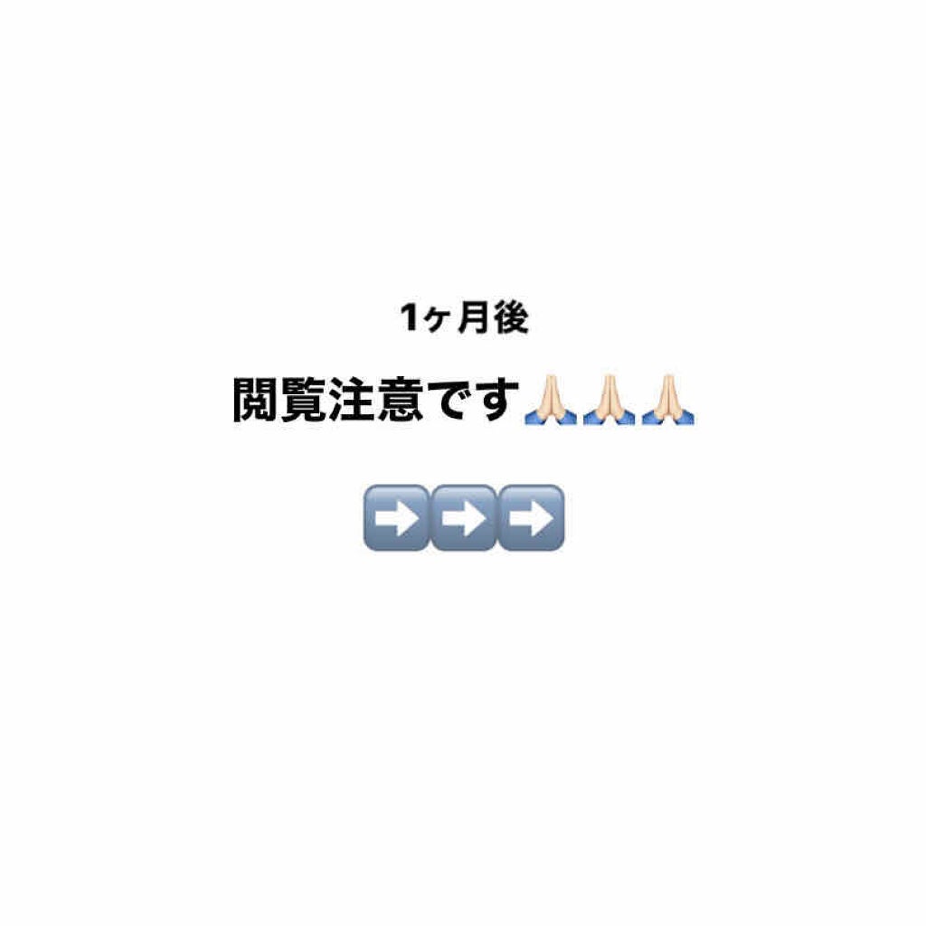 A アクネフォーム/NOV/洗顔フォームを使ったクチコミ(1枚目)