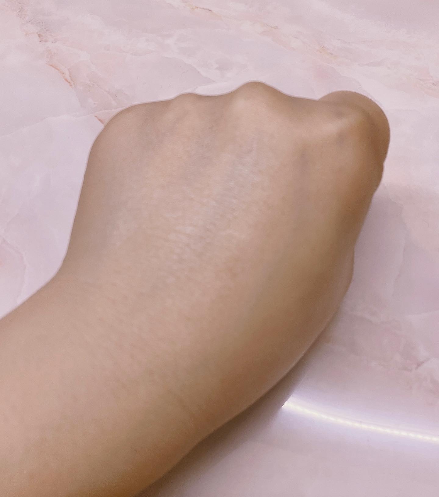 シカレチA クリーム0.05/VT/フェイスクリームを使ったクチコミ（3枚目）