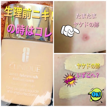 アクネカバーアップリキッドフレッシュ/CLINIQUE/リキッドファンデーションを使ったクチコミ(1枚目)