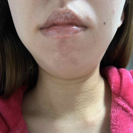 リップエッセンス/リッツ/リップグロスを使ったクチコミ(4枚目)