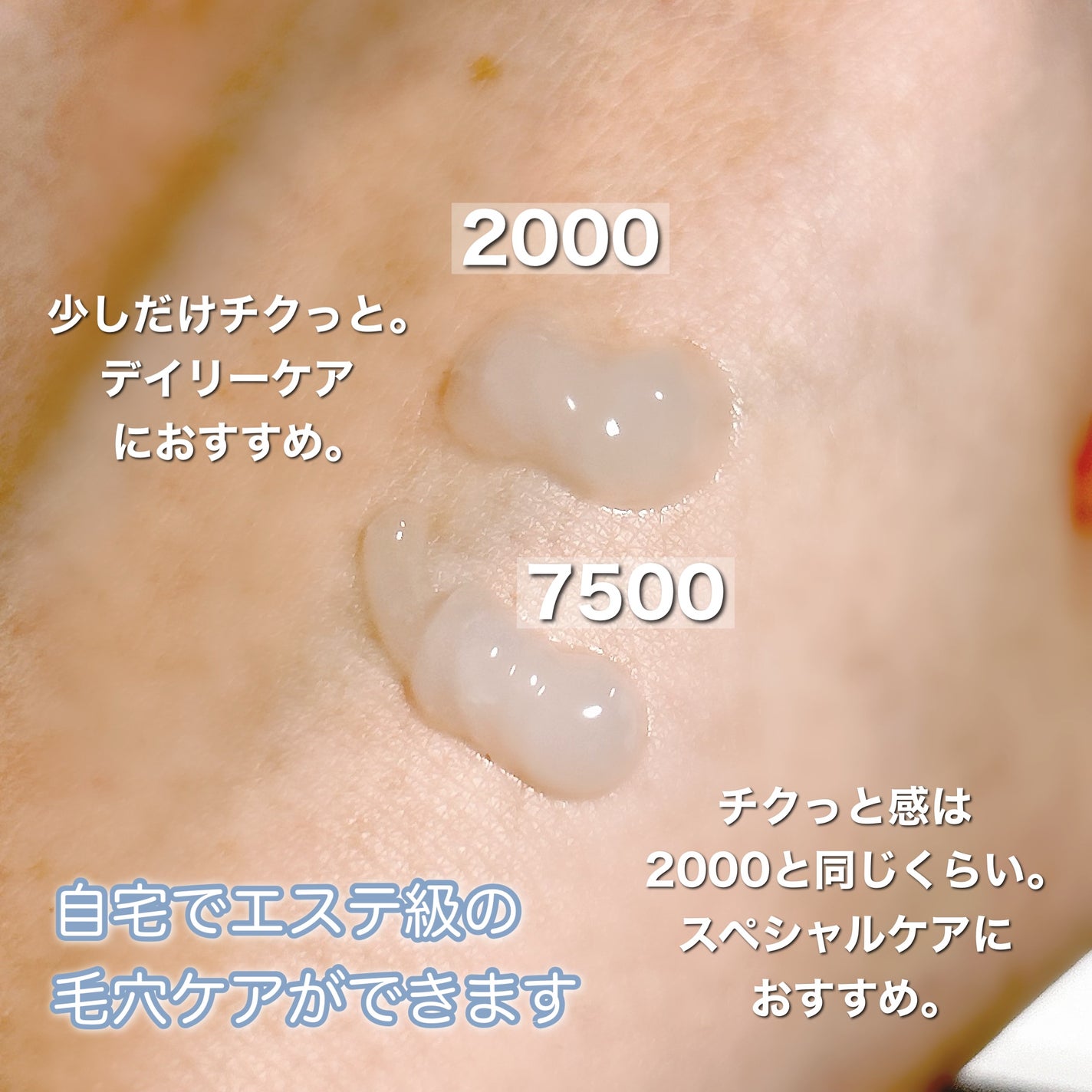 ゼロ1DAYエクソソームショット2000/MEDICUBE/美容液を使ったクチコミ(3枚目)