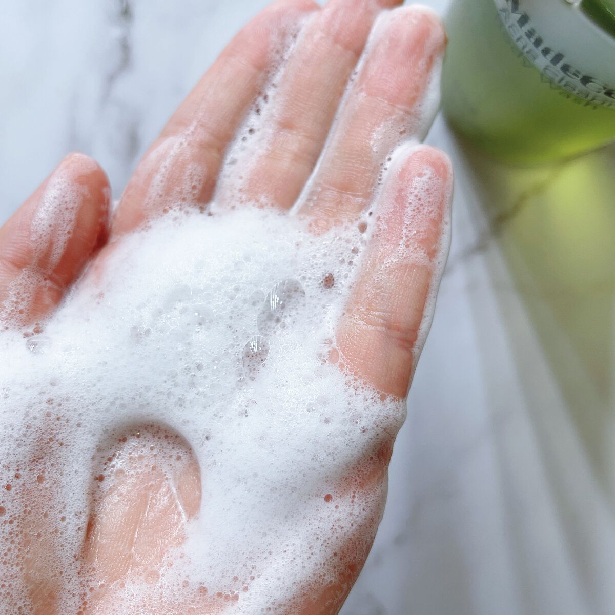 マデセラニキビクリアリングボディウォッシュ/SKINRx LAB/ボディソープを使ったクチコミ（3枚目）