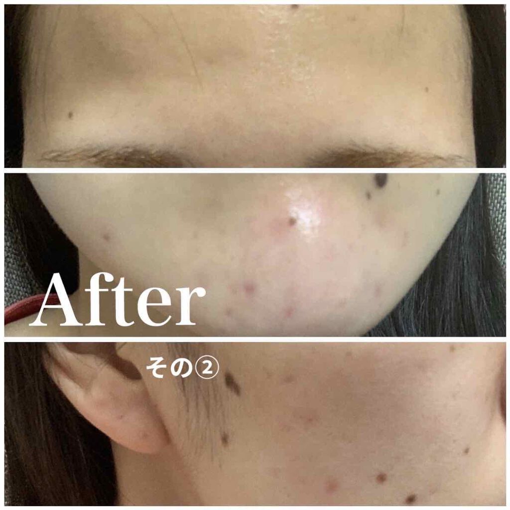 明色美顔水 薬用化粧水/美顔/化粧水を使ったクチコミ(4枚目)