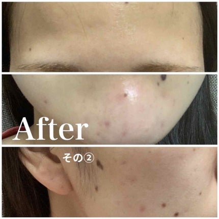 明色美顔水 薬用化粧水/美顔/化粧水を使ったクチコミ(4枚目)