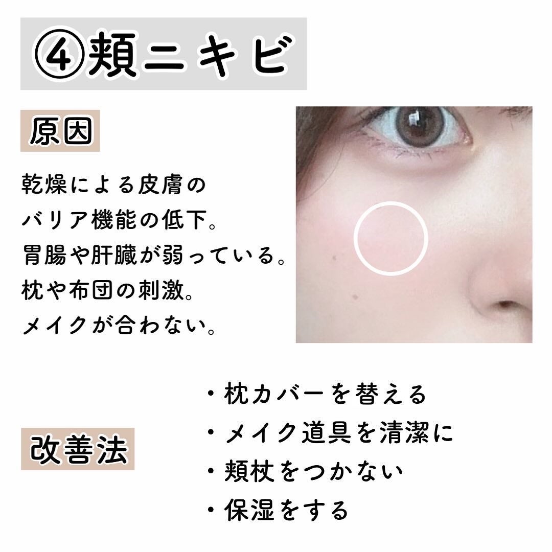 明色美顔水 薬用化粧水/美顔/化粧水を使ったクチコミ(5枚目)