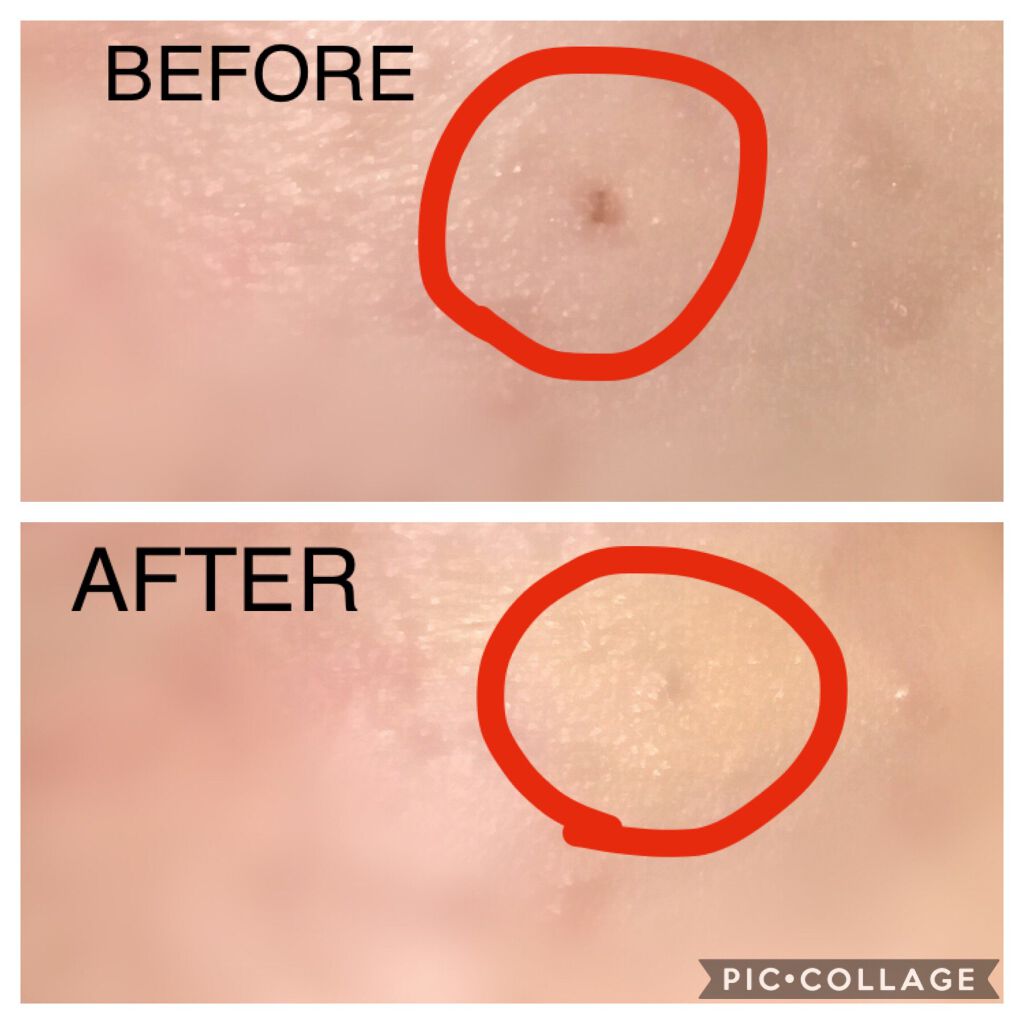 スタンプカバーコンシーラー/キャンメイク/リキッドコンシーラーを使ったクチコミ(3枚目)