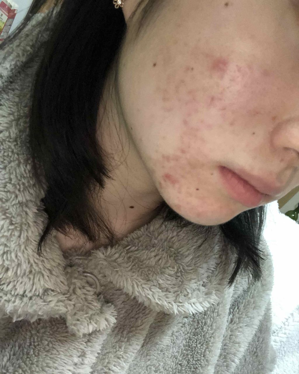 マンスリースキンケアプログラム(旧)/APEX/スキンケアキットを使ったクチコミ（3枚目）