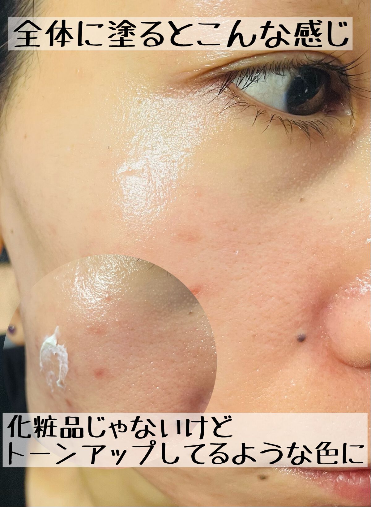 キップパイロール-Hi(医薬品)/佐藤製薬/その他を使ったクチコミ(2枚目)