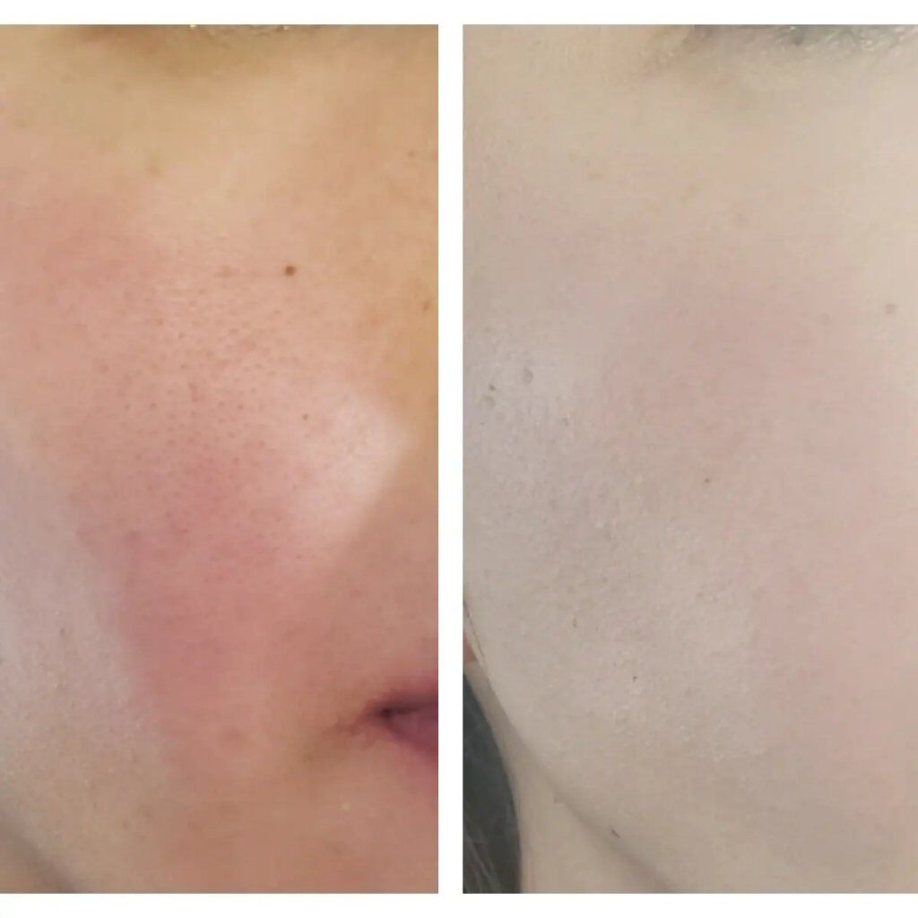 SIWA-KC オールインワンクッション/ハーブ健康本舗/クッションファンデーションを使ったクチコミ（3枚目）