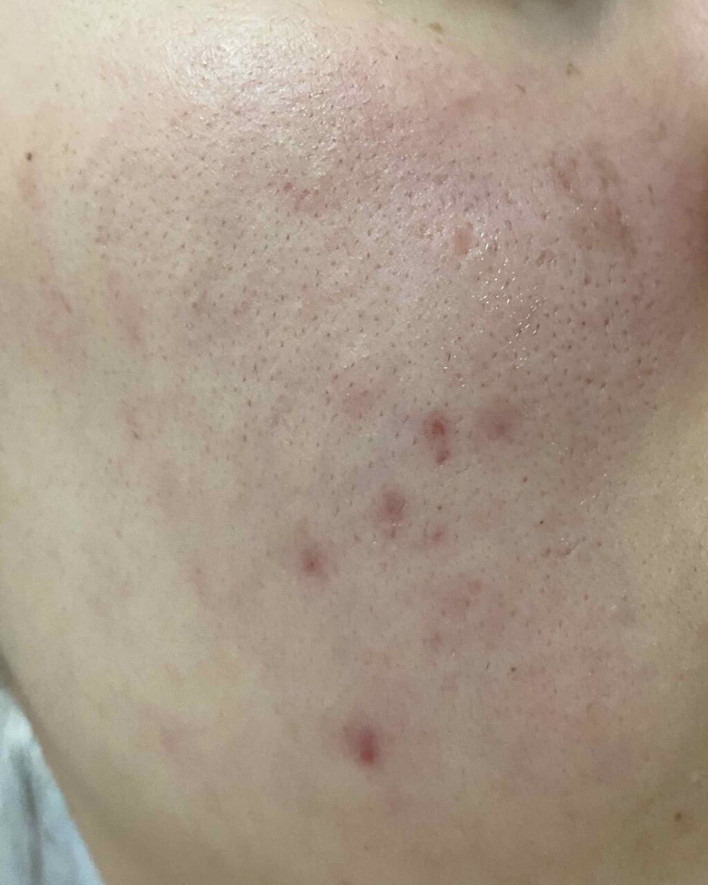 ハトムギ洗顔フォーム/株式会社イヴ/洗顔フォームを使ったクチコミ(2枚目)