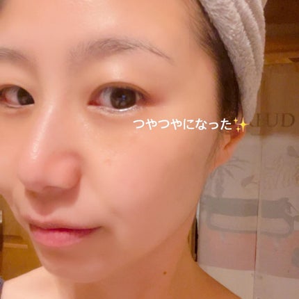 ダーマスキンピーリング/BQCELL/その他キットセットを使ったクチコミ(8枚目)