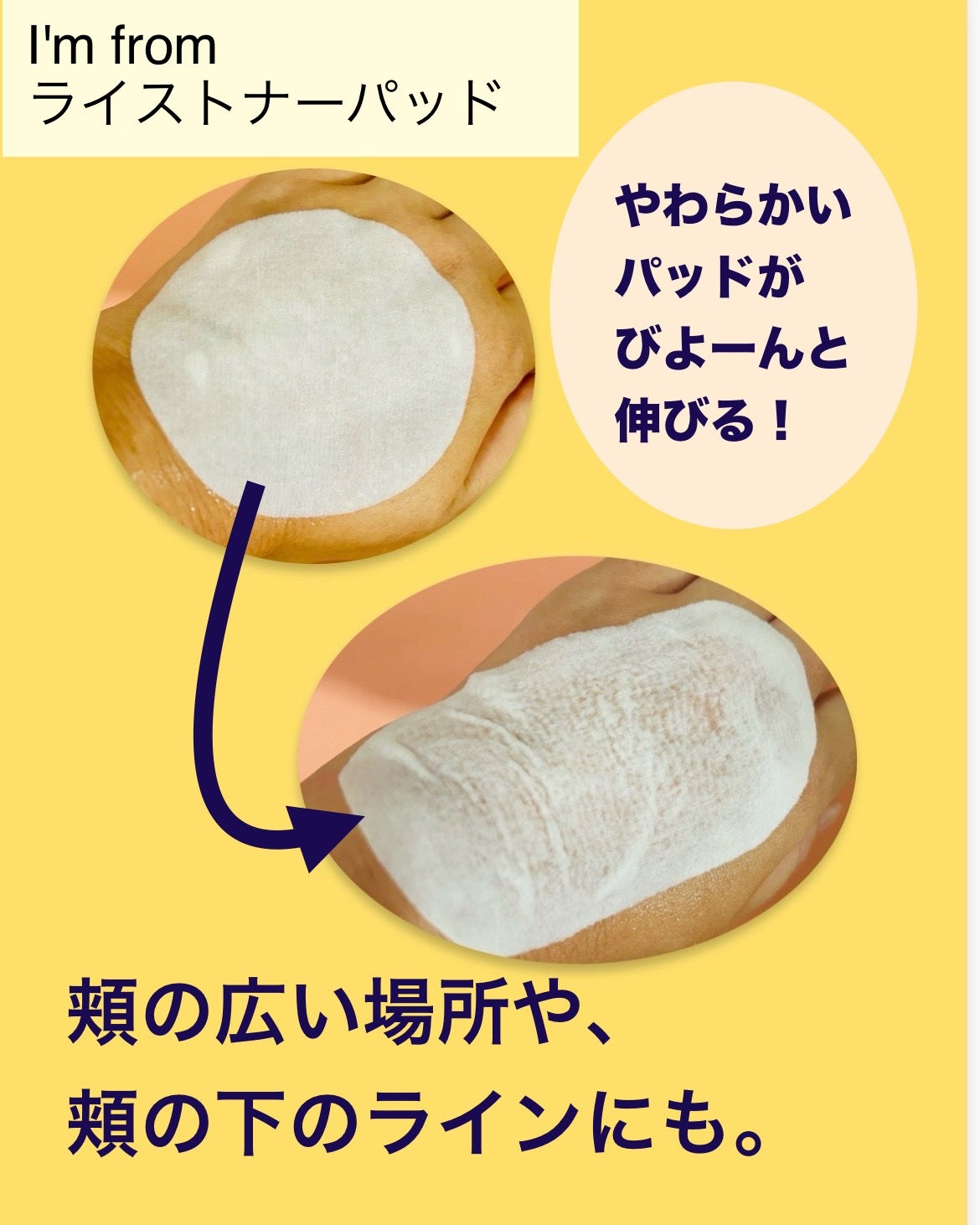 ライストナーパッド/I'm from/トナーパッドを使ったクチコミ(2枚目)