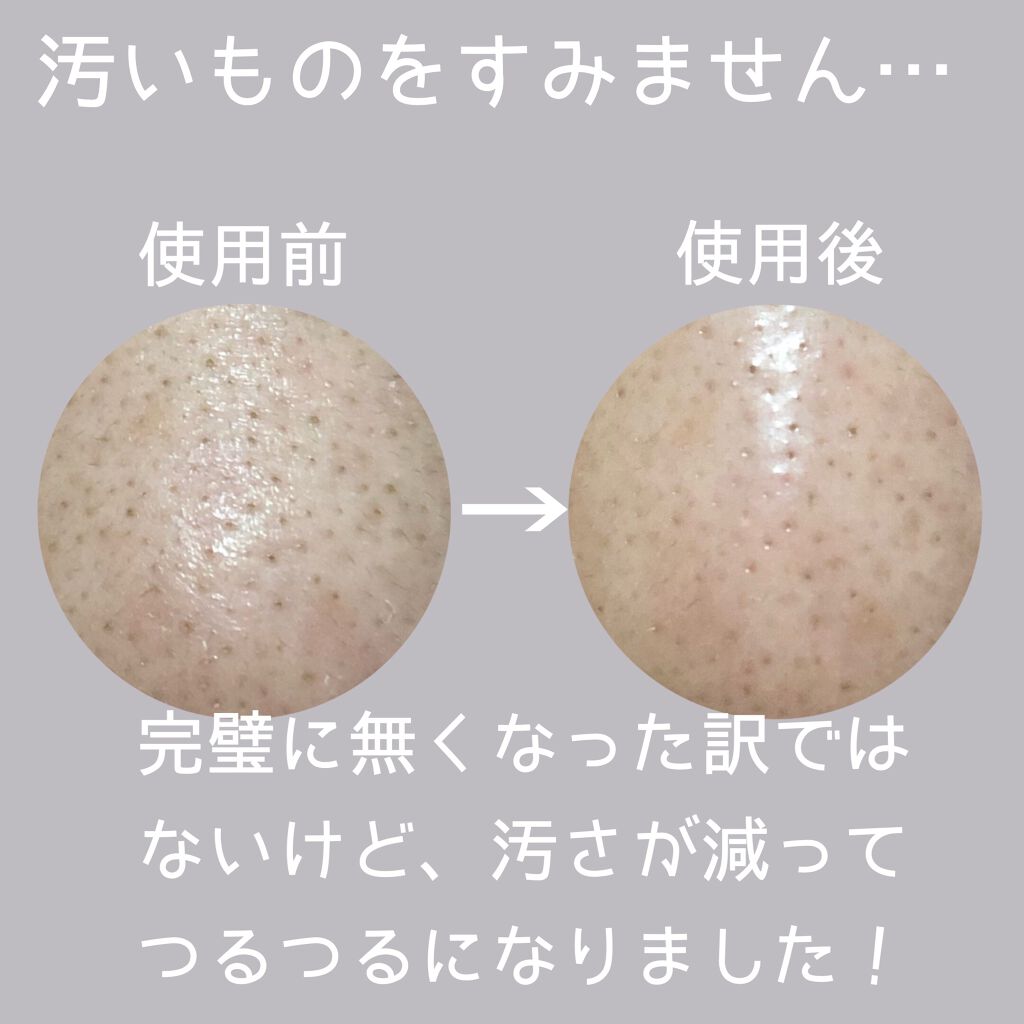 ノーモアブラックヘッド(ノーズピーリング)/One-day's you/スクラブ・ゴマージュを使ったクチコミ(2枚目)