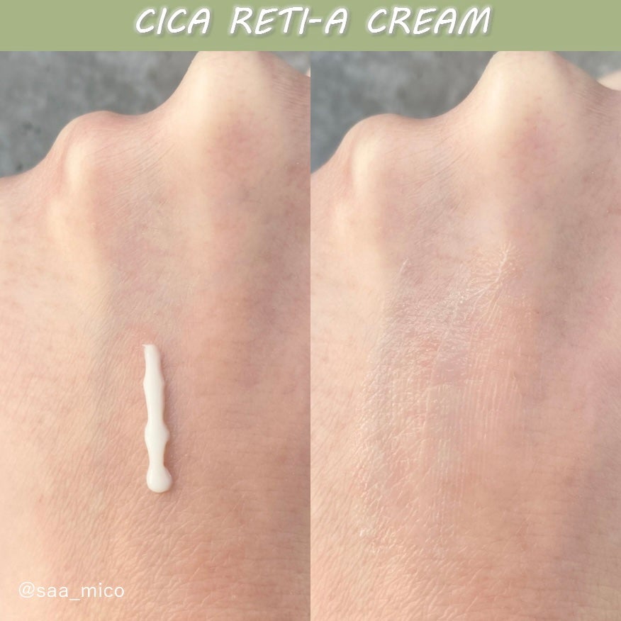 シカレチA クリーム0.05/VT/フェイスクリームを使ったクチコミ(2枚目)