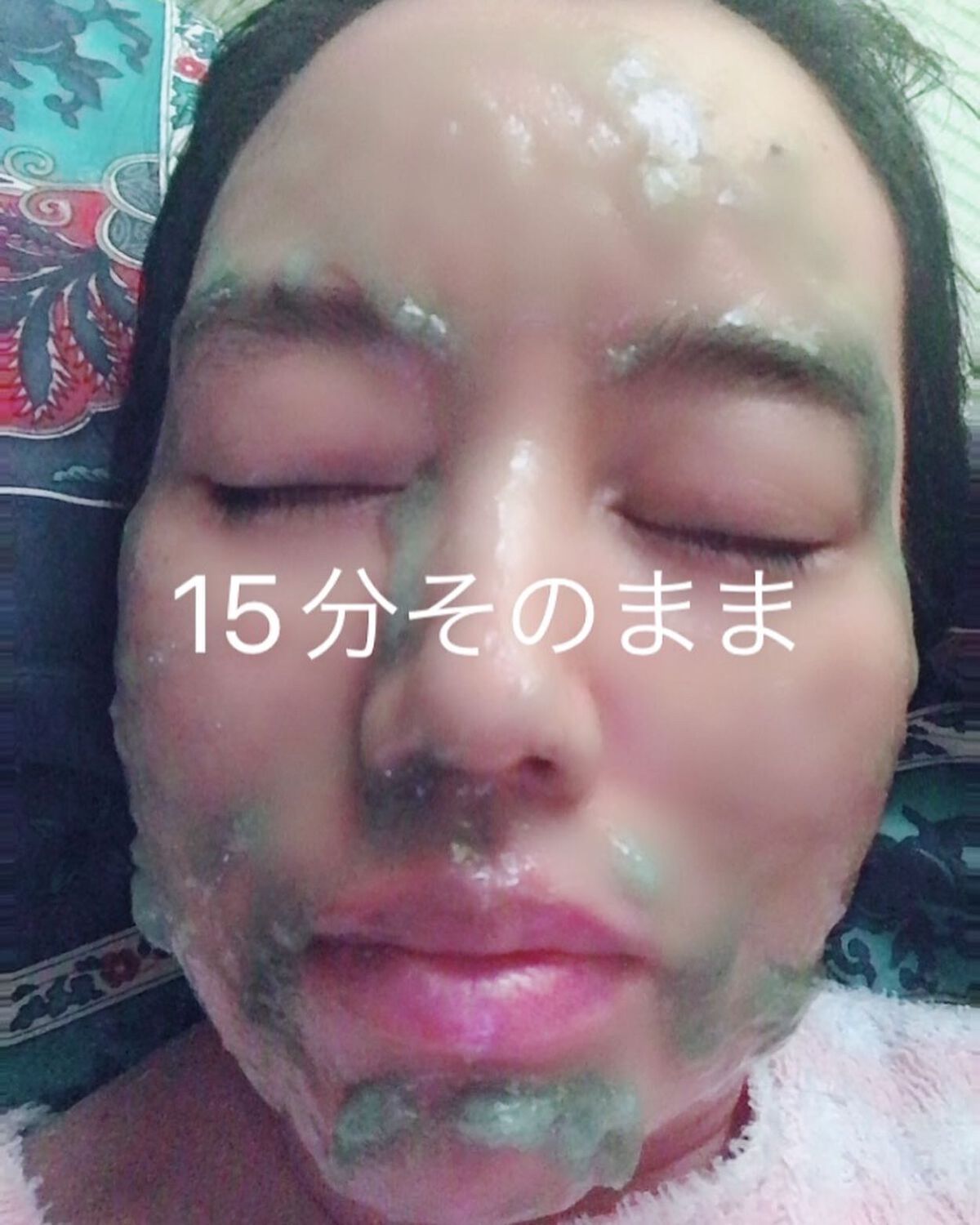 ニードル炭酸パック/NNE/洗い流すパック・マスクを使ったクチコミ(9枚目)