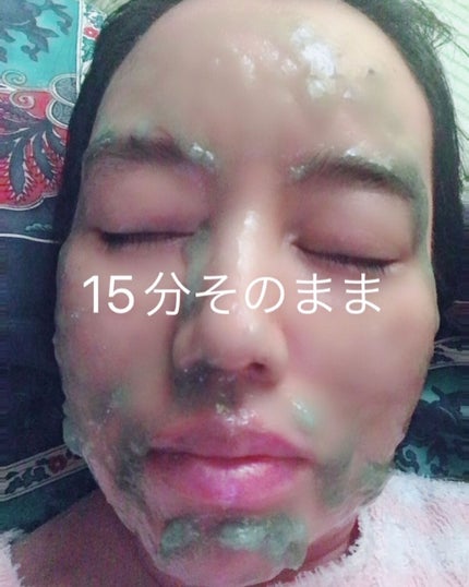 ニードル炭酸パック/NNE/洗い流すパック・マスクを使ったクチコミ(9枚目)