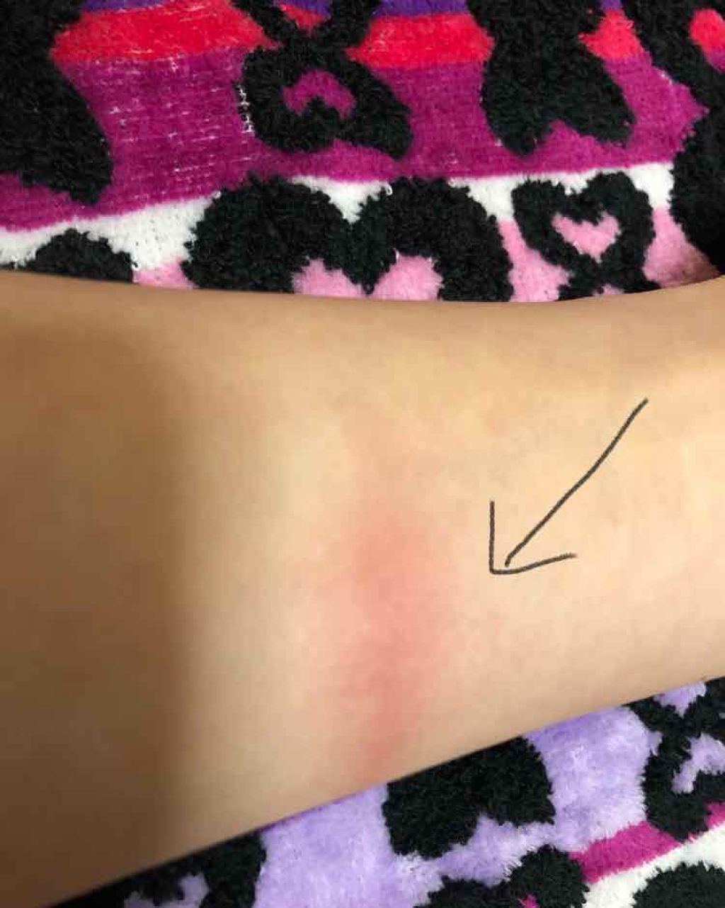 アイ&フェイスカラー/ANNA SUI/パウダーチークを使ったクチコミ(3枚目)