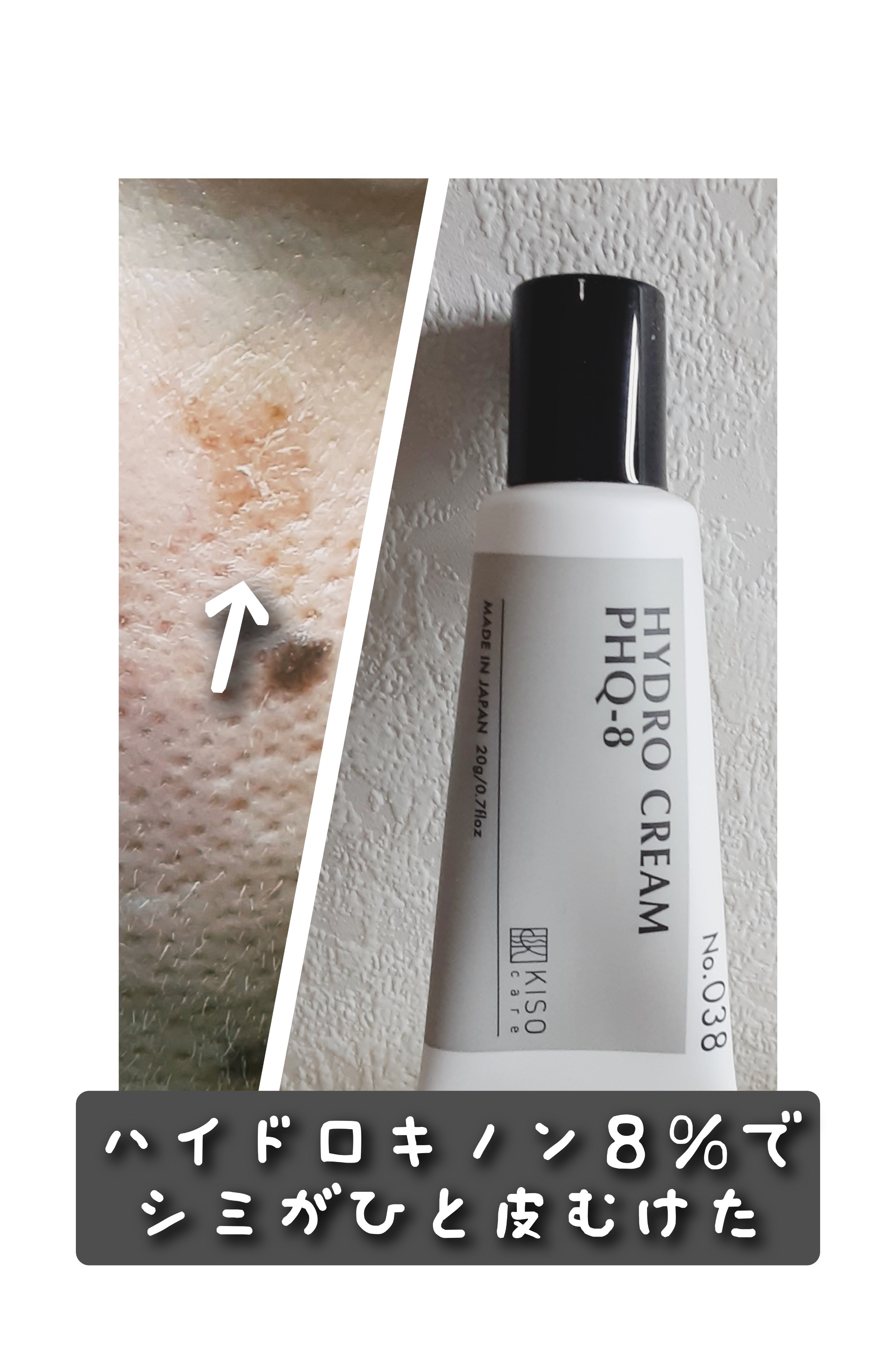 ハイドロクリームPHQ-8/KISO/美容液を使ったクチコミ（1枚目）