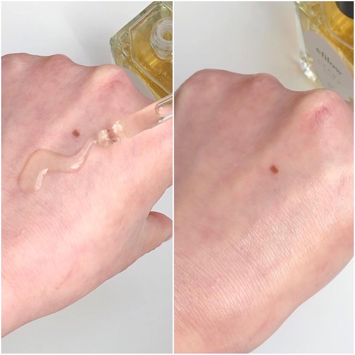 キメケア カバノアナタケバイオームアンプル/efilow/美容液を使ったクチコミ（3枚目）