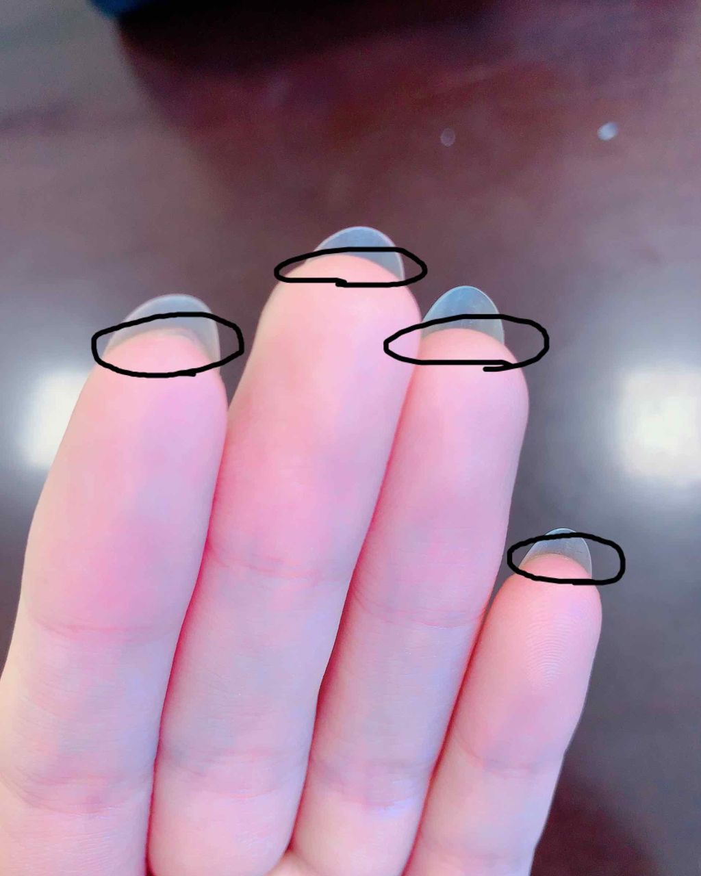 mikumið
ð on LIPS ãåæçš¿ã§ãïŒðŠãããããé¡ãããŸãïŒïŒïŒãã€ã«ã±ã¢ãããã®ã«ã..ãïŒ3æç®ïŒ