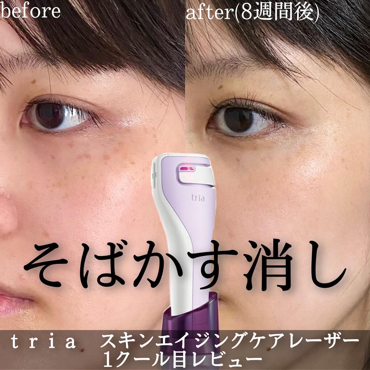 tria トリア スキンエイジングケアレーザー ライラック 美顔器美顔器 ...