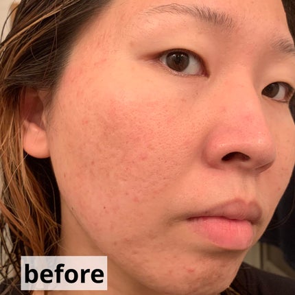 アクアコンフォーター/TWANY/化粧水を使ったクチコミ(7枚目)