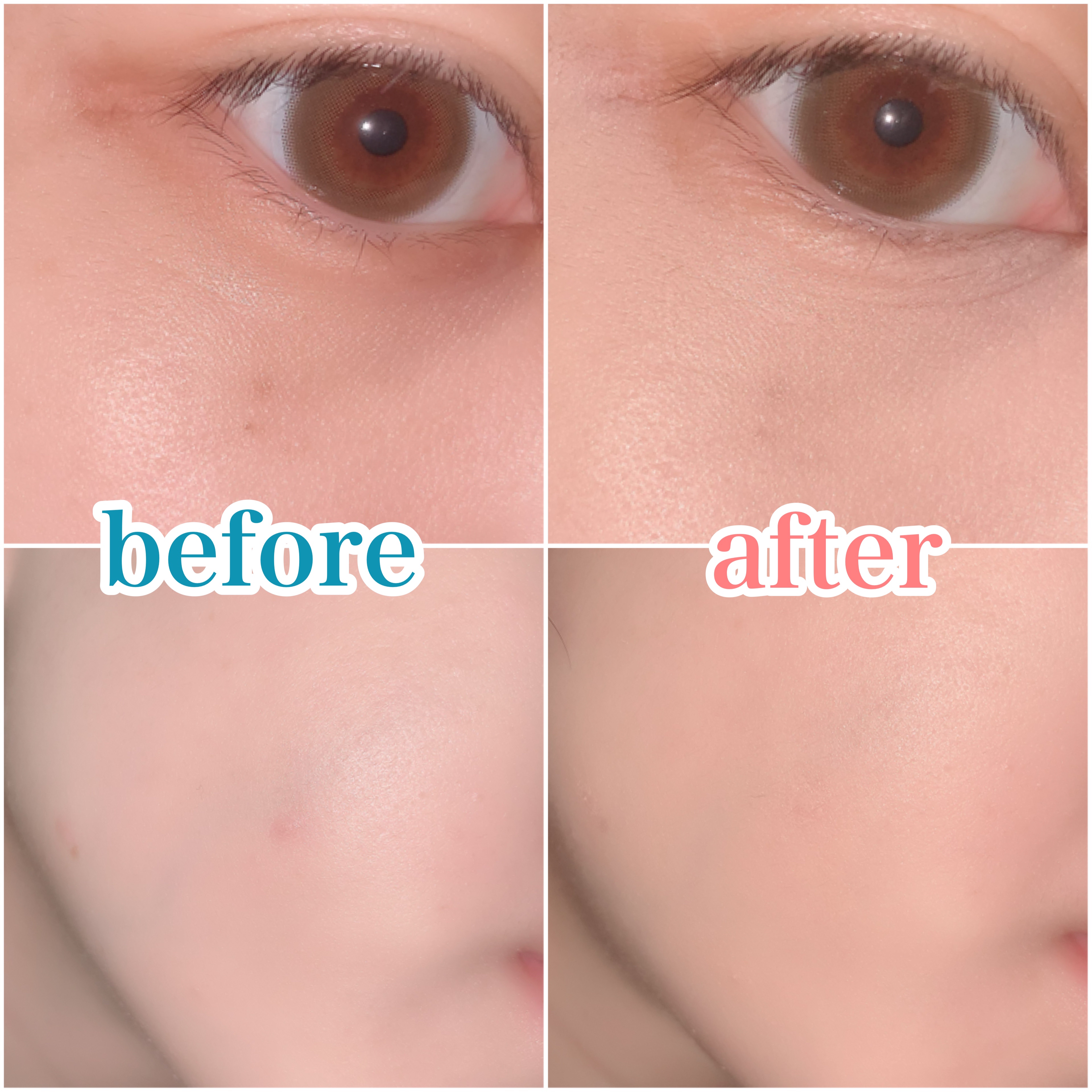 ロングラスティングチップコンシーラー/LUNA/リキッドコンシーラーを使ったクチコミ（3枚目）