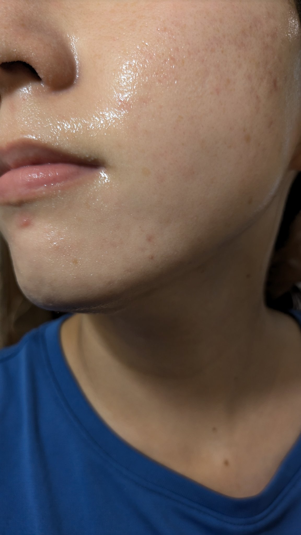 A2+NAG2ソリューション/The Ordinary/美容液を使ったクチコミ（2枚目）