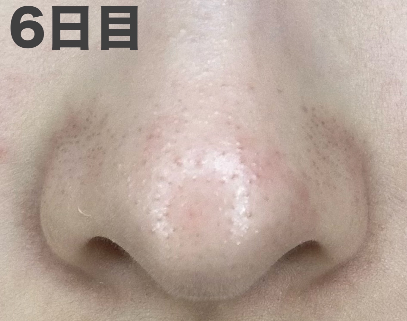 パーフェクトワンフォーカス スムースクレンジングバーム ディープブラック クロミ 限定デザイン（75g）/PERFECT ONE  FOCUS/クレンジングバームを使ったクチコミ（2枚目）