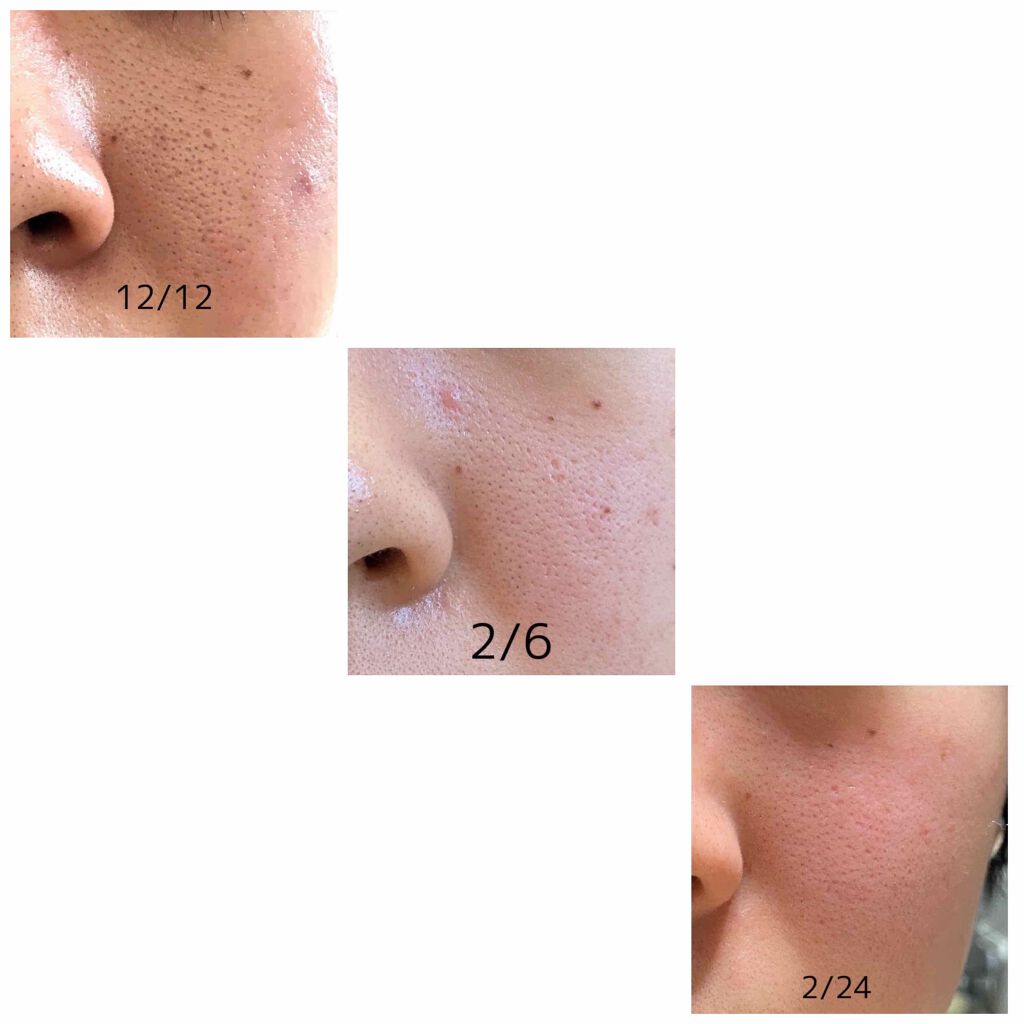 エクサージュ アクティベーション モイスチュア ミルク II/ALBION/乳液を使ったクチコミ（2枚目）