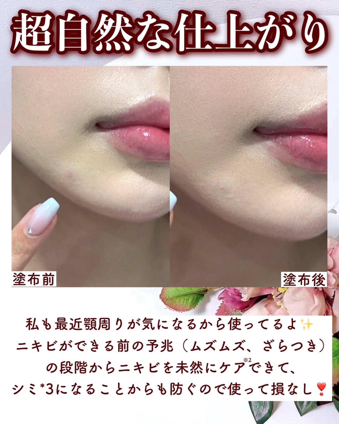 イプノス シーバムクリア リペアクリーム/ACSEINE/フェイスクリームを使ったクチコミ(5枚目)