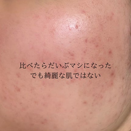 DHC 薬用ディープクレンジングオイル 120ml/DHC/オイルクレンジングの画像