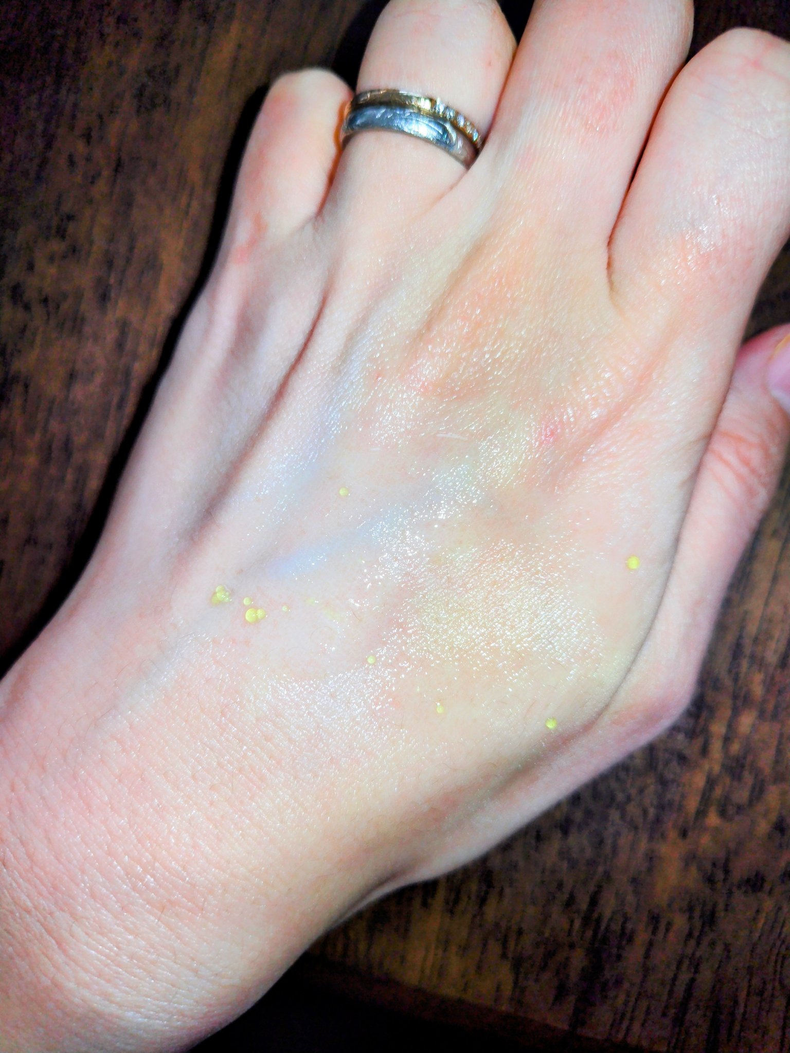 レチノコラーゲン低分子300パンピングアンプル/CKD/美容液を使ったクチコミ（3枚目）