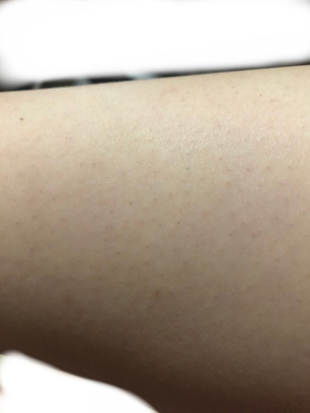 アイスレディ/icelady/家庭用脱毛器を使ったクチコミ(3枚目)