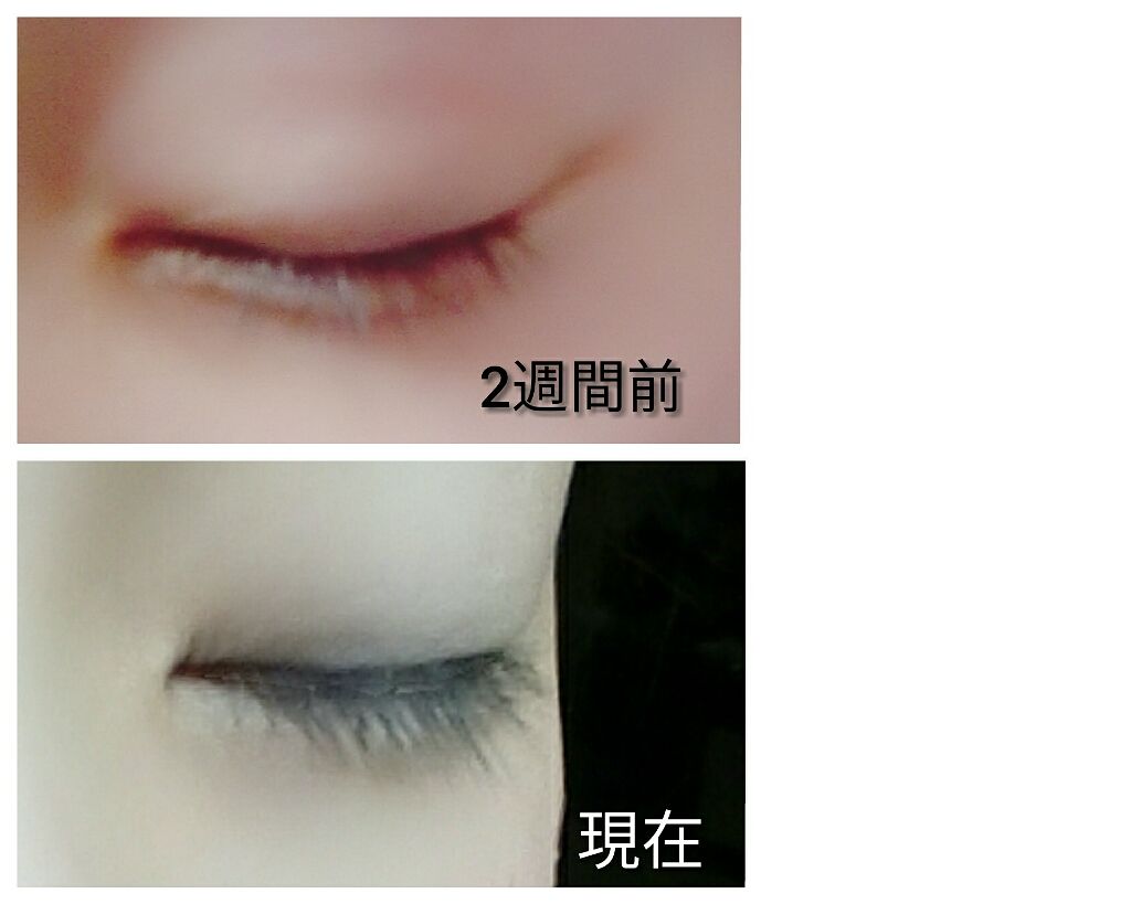 ローヤルゼリー配合 栄養ローション/DAISO/美容液を使ったクチコミ（2枚目）