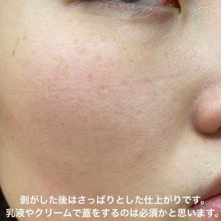 我的美麗日記(私のきれい日記) 雪真珠コンディショニングマスク/我的美麗日記/シートマスク・パックを使ったクチコミ(10枚目)