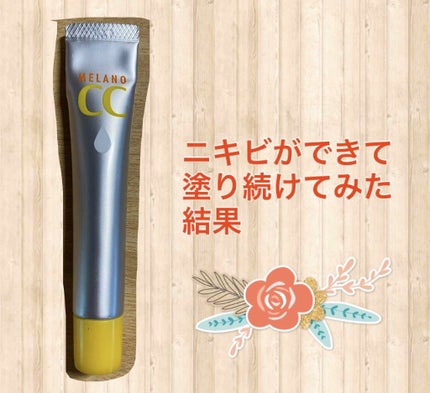 ペアアクネクリームW(医薬品)/ペア/その他を使ったクチコミ(1枚目)