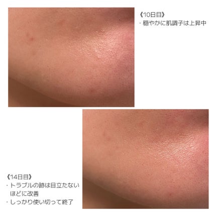 セラムオプティマイザー/AYURA/美容液を使ったクチコミ(7枚目)