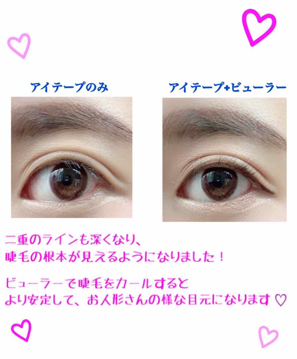 ワンダーアイリッドテープ Extra/D-UP/二重まぶた用アイテムを使ったクチコミ(3枚目)