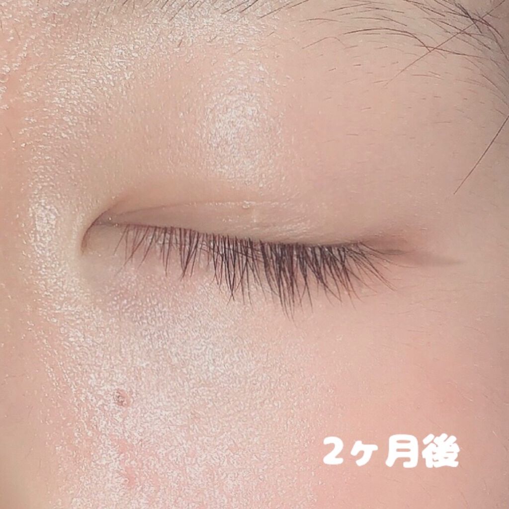 まつげ美容液EX/CEZANNE/まつげ美容液を使ったクチコミ(3枚目)
