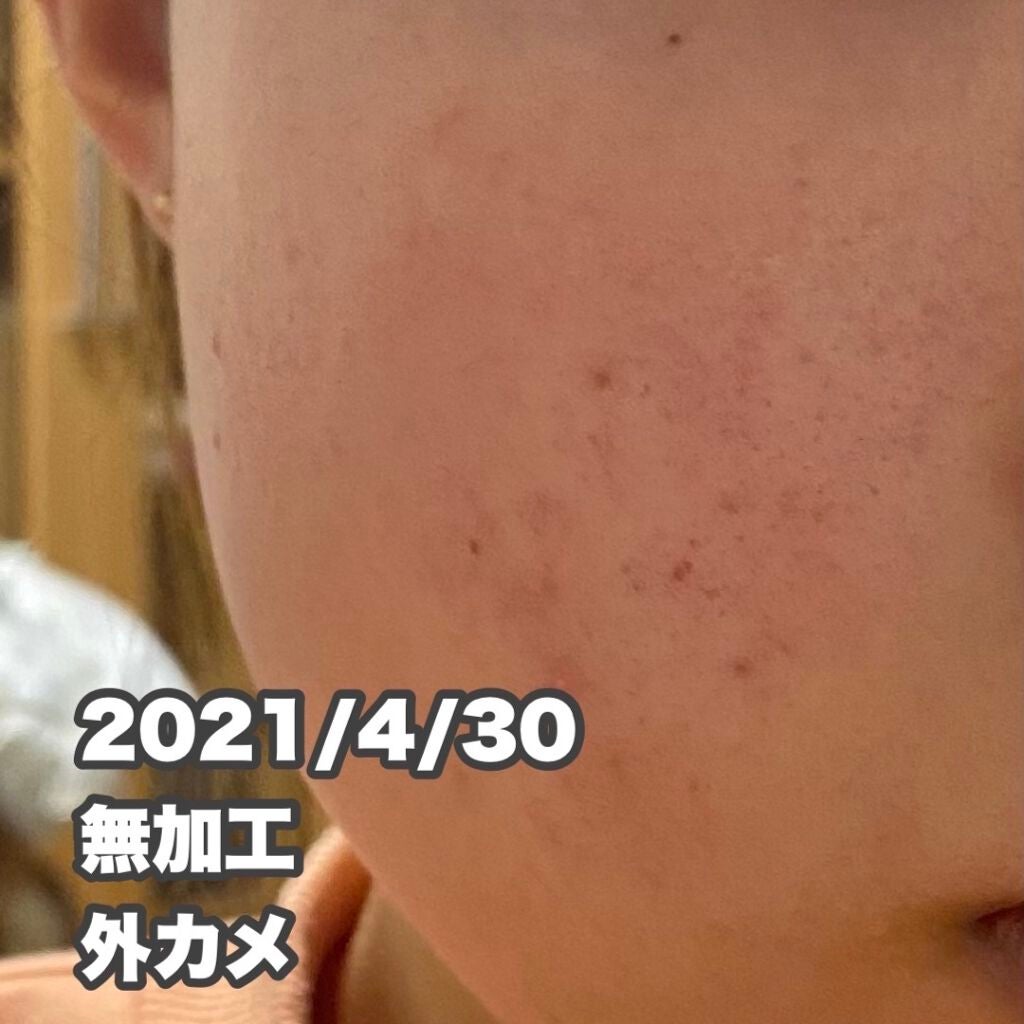 ドクタージャルト シカペア クリーム (第2世代)/Dr.Jart+/フェイスクリームを使ったクチコミ(4枚目)