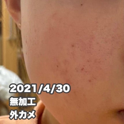 ドクタージャルト シカペア クリーム (第2世代)/Dr.Jart+/フェイスクリームを使ったクチコミ(4枚目)