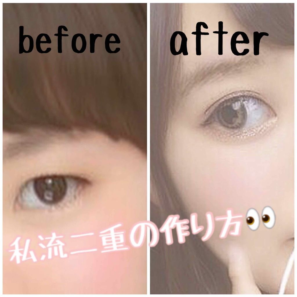 のびーるアイテープ（絆創膏タイプ、レギュラー）/DAISO/二重まぶた用アイテムを使ったクチコミ（1枚目）