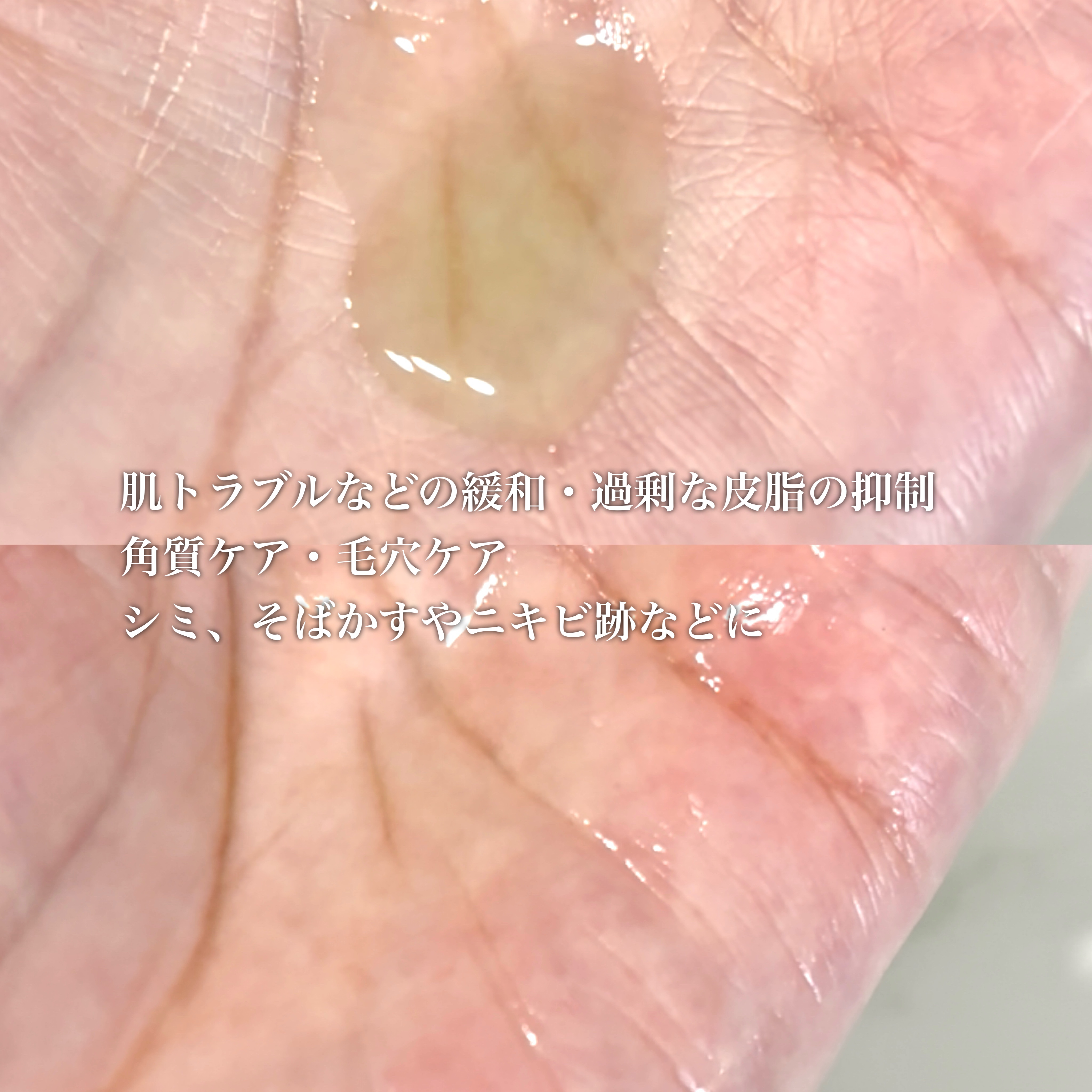 アゼライン酸15 インテンスカーミングセラム/Anua/美容液を使ったクチコミ（3枚目）