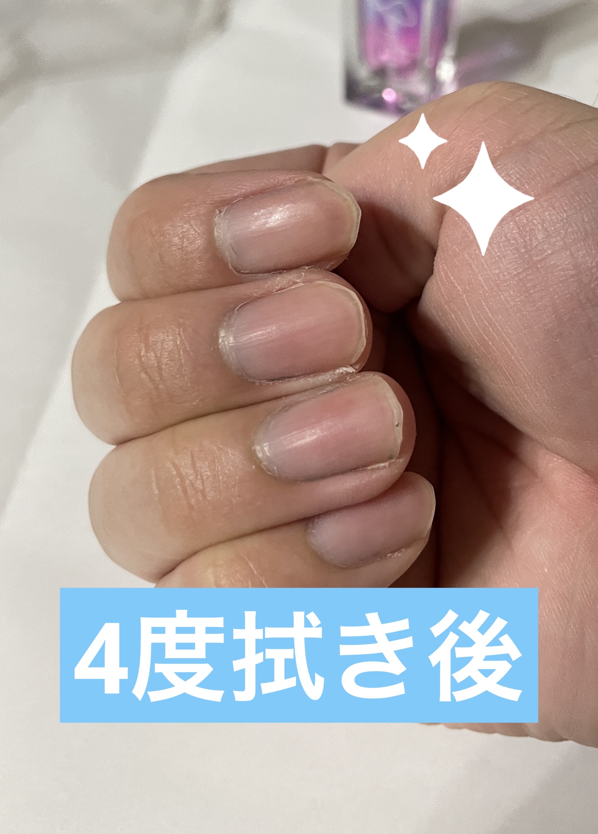 除光液/ちふれ/除光液を使ったクチコミ（2枚目）