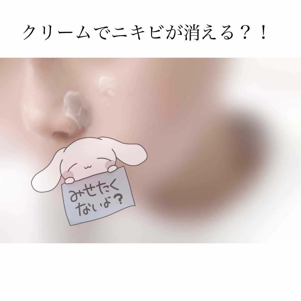 アンナザルベ・エース(医薬品)/エスエス製薬/その他を使ったクチコミ（3枚目）