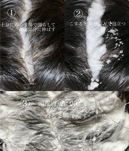 スパークリングスカルプスケーラー/ミンツリー/頭皮ケアを使ったクチコミ(3枚目)